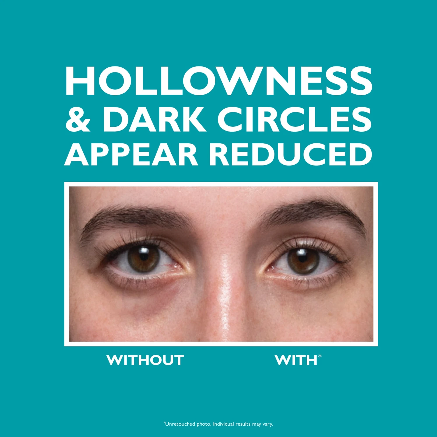 Peter Thomas Roth Peptide Skinjection Fill + Fix Under Eye Cream 4 Peter Thomas Roth Peptide Skinjection Fill + Fix Under Eye Cream - Image 4