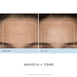 NuFACE Trinity Pro Facial Toning Kit + ELE -Camera Ready Cosmetics 09NF AltImages2 Trinity TWR 7 2000x2000 4d65c9db ff85 4840 99e7 29045fe4d450