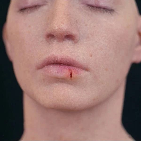 Out Of Kit Split Lip 2 Out Of Kit Split Lip - Image 2