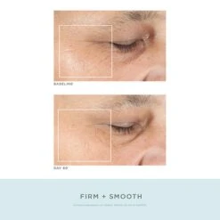 NuFACE Trinity Pro Facial Toning Kit + ELE -Camera Ready Cosmetics 3.40192 NF 2000x2000 ELE Attachment alt3 7cbafe83 d265 40ab 95e5 1f3e12eb8587