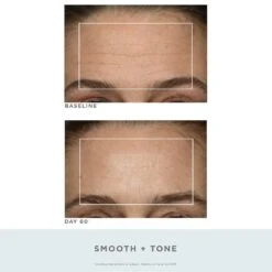 NuFACE Trinity Pro Facial Toning Kit + Wrinkle Reducer -Camera Ready Cosmetics 4.40158 NuFACE 2000x2000 TWR B A2 9de00c82 6492 4295 906b 1254551320ff