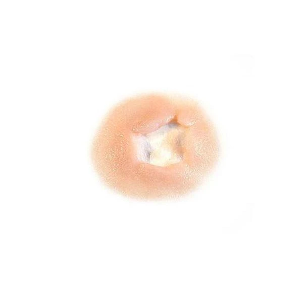 Out Of Kit Exit Wound (Small) 1 Out Of Kit Exit Wound (Small)