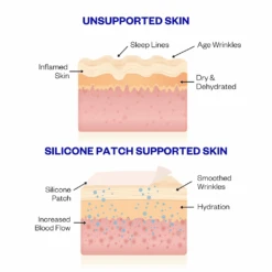 Wrinkles Schminkles Eye Wrinkle Patches - 3 Pairs -Camera Ready Cosmetics How to use silicone wrinkle pad 1 3aafd753 bcf6 45d4 ab1c 8326467597d7