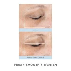 NuFACE FIX -Camera Ready Cosmetics NF FIX BA 1 1800x1800 v2