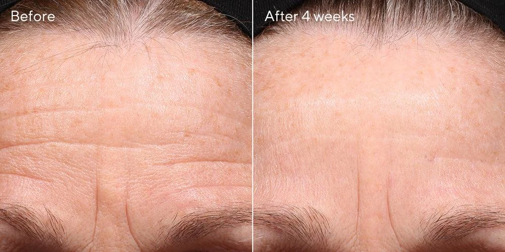 Murad Retinol Youth Renewal Night Cream 3 Murad Retinol Youth Renewal Night Cream - Image 3